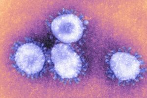 covid virus GettyImages-151039393